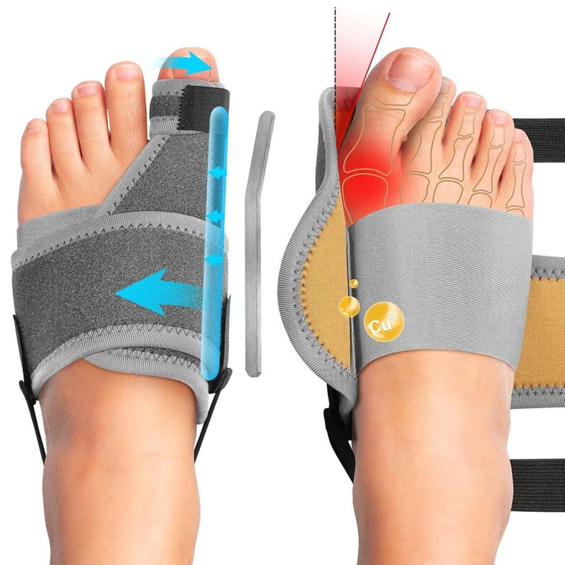 Laad afbeelding in Galerijviewer, Hallux valgus correctors 2 stuks met verstelbare teenbandage en aluminium spalken – teenspreiders – voetondersteuning - happygetfit.com
